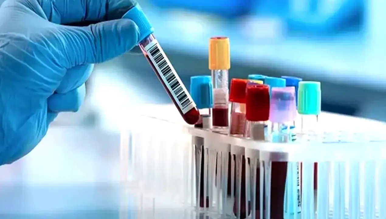 آزمایش‌های خونی 